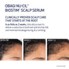Advertisement for Obagi Nu-Cil Biostim Scalp Serum showing scalp health improvement over time.